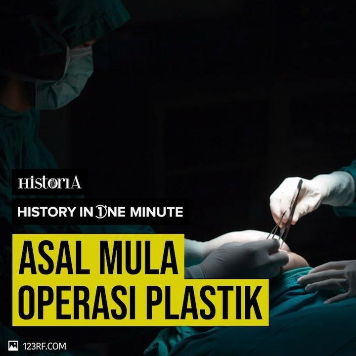 Mula Operasi Plastik - Historia